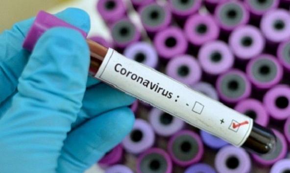 Dương tính yếu và tái dương tính COVID-19 có lây nhiễm hay không?