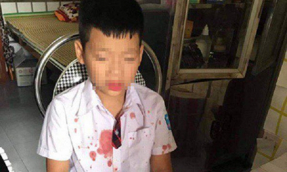 Phụ huynh học sinh lớp 1 bị hành hung: 'Tinh thần cháu vẫn hoảng loạn, không muốn đến trường'