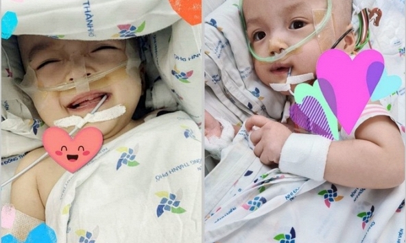 Hai bé Trúc Nhi, Diệu Nhi khỏe mạnh, ăn sữa tốt, bàn chân và ngón chân cử động thoải mái