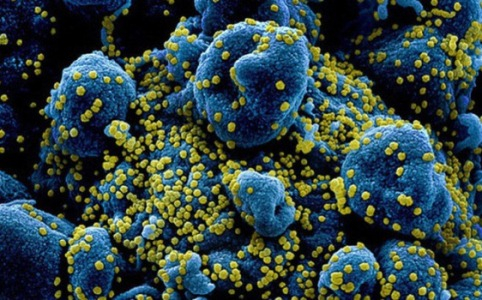 Cơn bão cytokine có thể là nguyên nhân khiến người bệnh Covid-19 tử vong