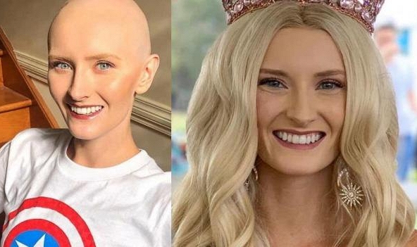 Tân Hoa hậu Trái Đất Australia 2020 và hành trình chiến thắng ung thư não