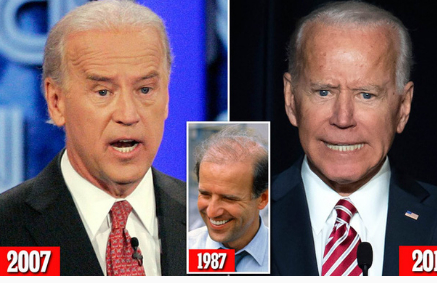 Bằng chứng cho thấy Ông Joe Biden phẫu thuật thẩm mỹ để 'níu kéo tuổi xuân'