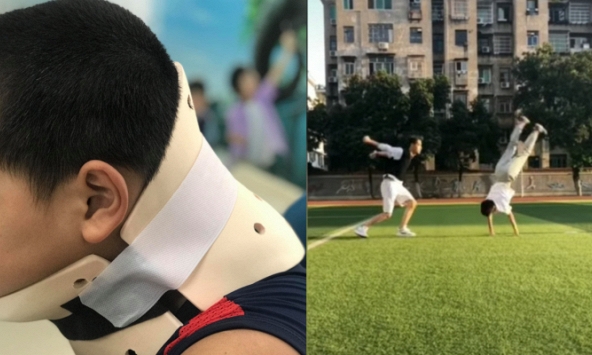 Bé trai 10 tuổi bị vẹo cổ vì học theo trò nhào lộn trên Tik Tok