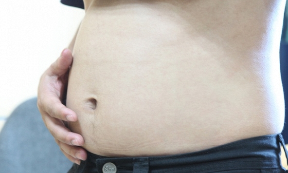 Uống thực phẩm chức năng, bụng người đàn ông phình to như mang bầu