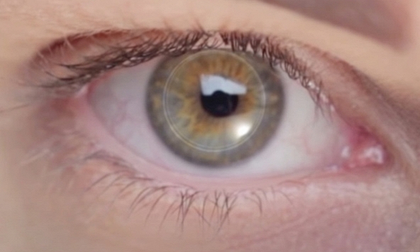 Cụ ông 78 tuổi bị mù suốt 10 năm đã hồi phục thị giác nhờ cấy ghép giác mạc nhân tạo