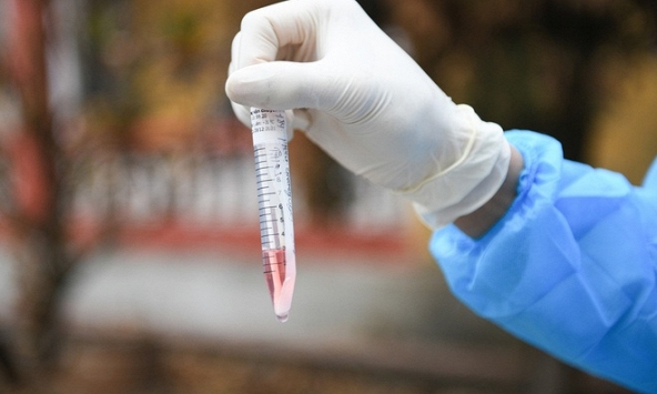 512 mẫu xét nghiệm ở Quảng Ninh âm tính với Covid-19