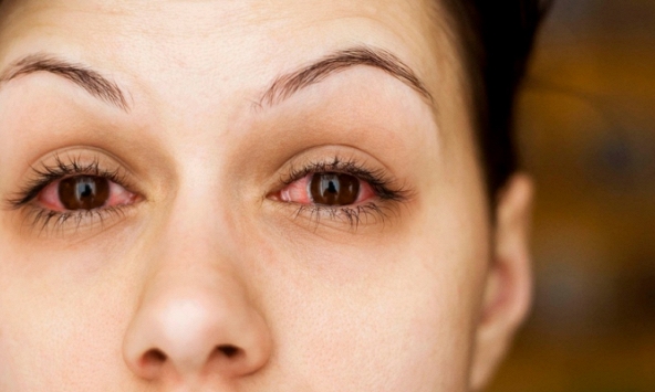 Nhiều bệnh nhân Covid-19 xuất hiện triệu chứng đặc biệt