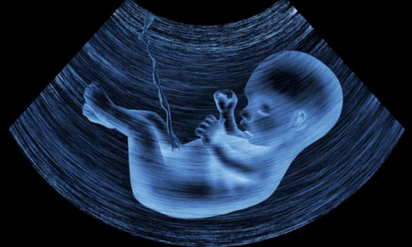 Thai nhi chết lưu vì nhiễm Covid-19 từ trong bụng mẹ