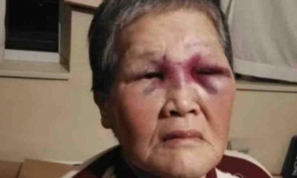 1 triệu USD ủng hộ cho cụ bà gốc Á bị tấn công tại Mỹ vì phân biệt chủng tộc