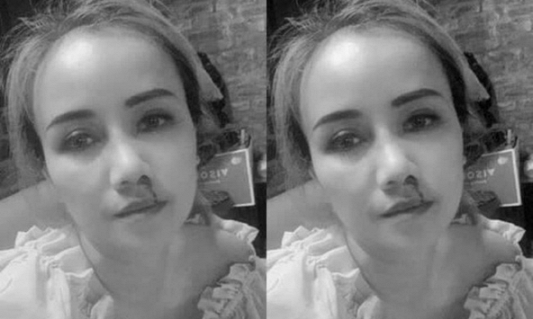 Công an vào cuộc vụ nữ diễn viên Hoàng Yến bị chồng cũ đánh gãy mũi