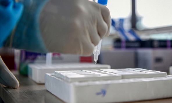 Test nhanh Covid-19 tại nhà cần lưu ý những gì?