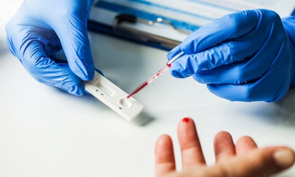 Bác sĩ Trương Hữu Khanh: Hiểu đúng về xét nghiệm kháng thể