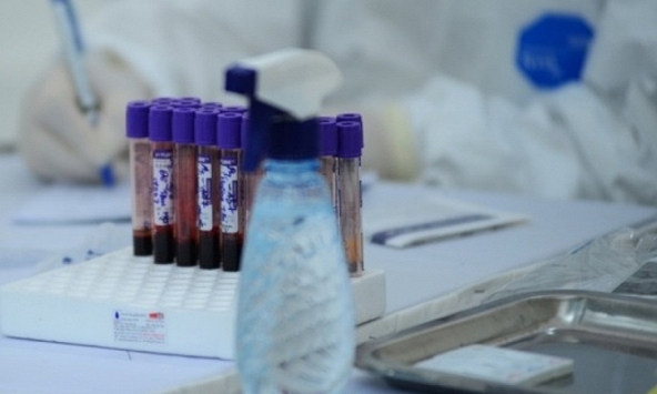 Người bệnh không phải trả bất kỳ chi phí nào khi được chỉ định xét nghiệm COVID-19