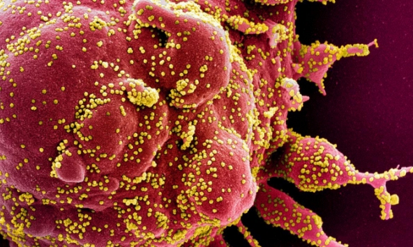 Người Nhật ít bị nhiễm, tử vong vì Covid-19 nhờ có gien lạ?