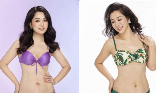 Hình ảnh bụng rạn của các thí sinh Hoa hậu khi mặc bikini gây tranh cãi