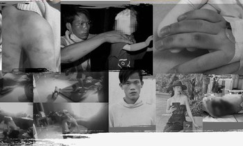 Những vụ bạo hành trẻ em gây rúng động dư luận năm 2021