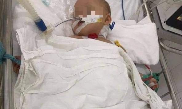 Bé gái 3 tuổi nghi bị bạo hành ở Hà Nội: Đã nhập viện 3 lần trước đó, vết thương trên đầu đã đóng vẩy