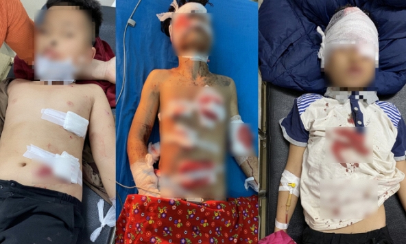 Tuyên Quang: 4 học sinh bị thương nặng khi dùng máy xay sinh tố để trộn hóa chất