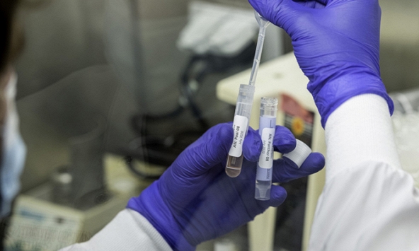 Hải quan thông tin doanh nghiệp nhập bộ xét nghiệm PCR giá 96.000-150.000 đồng, bán 395.000 đồng