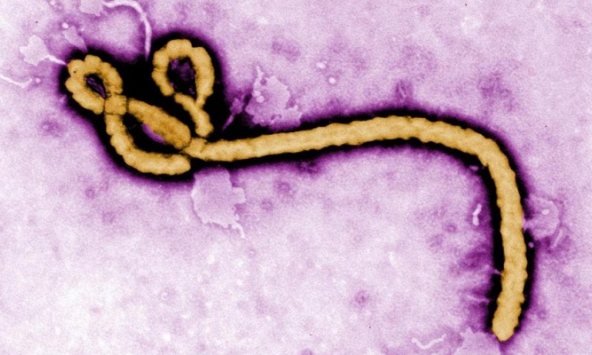 Nghiên cứu mới: Virus Ebola có thể “ẩn náu” trong cơ thể chờ ngày 'kích hoạt'