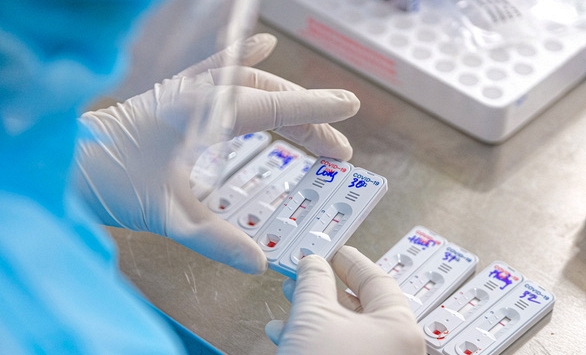 Quy định mới về giá xét nghiệm COVID-19: Test nhanh chỉ 78.000 đồng