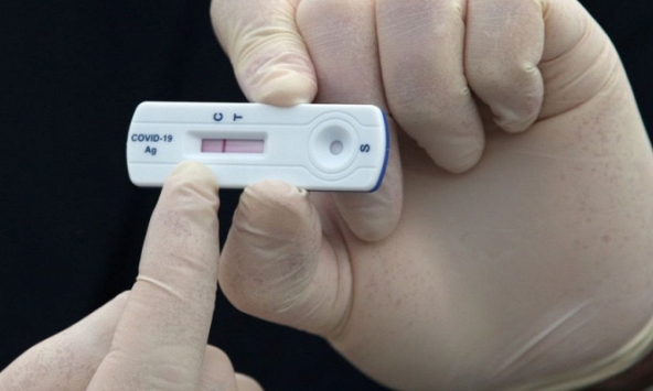 Sau khi tiếp xúc F0, nên test khi nào để có kết quả chuẩn nhất?