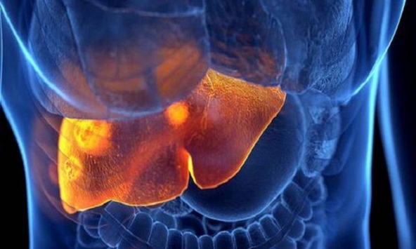 Các dấu hiệu cảnh báo viêm gan bí ẩn ở trẻ cha mẹ cần lưu ý