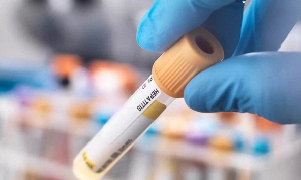 Trung Quốc đưa ra bộ xét nghiệm nhận biết bệnh viêm gan bí ẩn