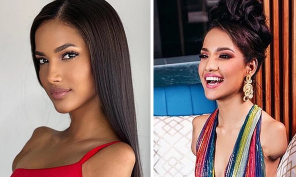 Mỹ nhân mất 2 tay và chân: minh chứng cho một dạng khác của cái đẹp