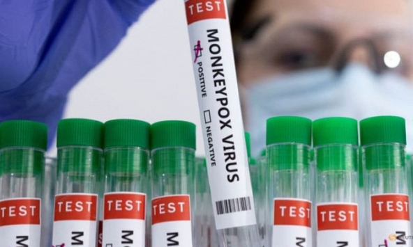 Bộ Y tế hướng dẫn các biện pháp phòng, chống tạm thời với bệnh đậu mùa khỉ