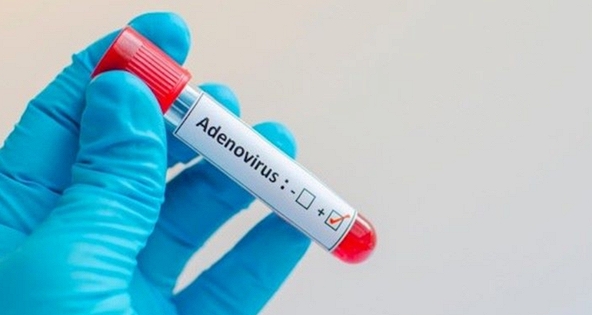 Khi nào cần xét nghiệm Adenovirus?