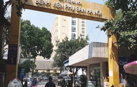 Bệnh viện Phụ sản Hà Nội công bố ca song thai cùng trứng cực kỳ đặc biệt