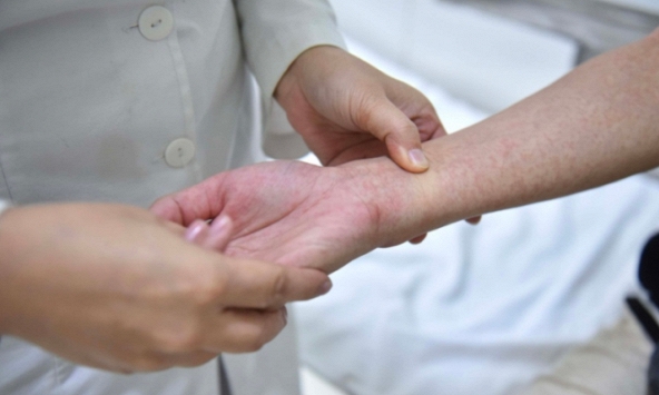 Hà Nội ghi nhận số ca mắc sốt xuất huyết tăng hơn 4 lần so với năm 2021