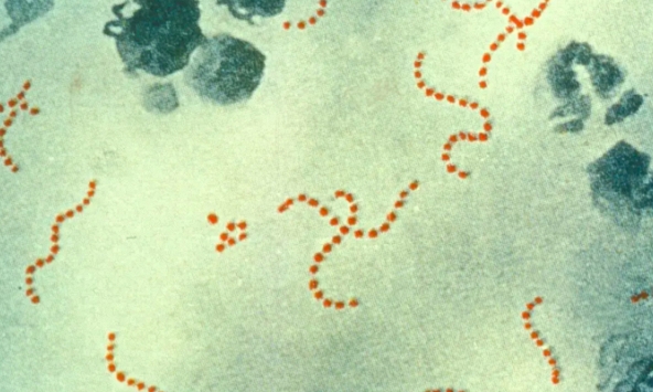 Nhiều trẻ em tử vong do nhiễm liên cầu khuẩn, WHO đưa ra cảnh báo 