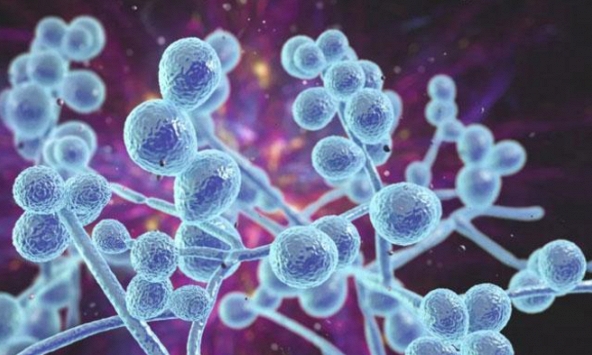 Dấu hiệu nhiễm nấm âm đạo điển hình chị em cần biết