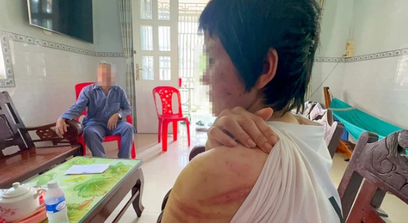 Vụ người phụ nữ tố chồng bạo hành ở Hải Dương: Các cấp Hội phụ nữ vào cuộc