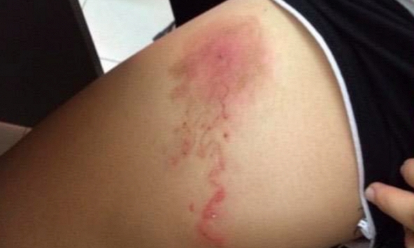 Chuyên gia cảnh báo bệnh nhiễm ký sinh trùng do thói quen nuôi thú cưng