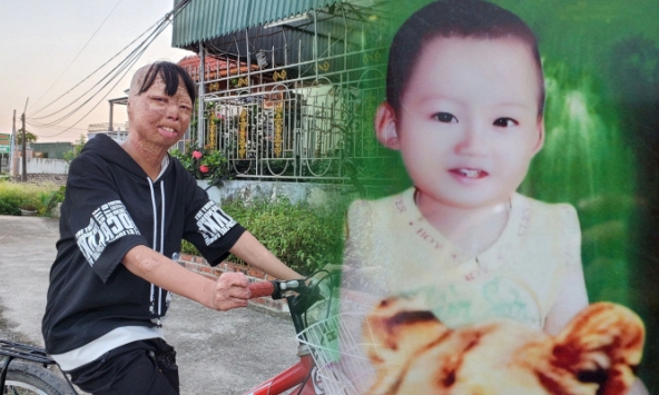 Cuộc sống hiện tại của cậu bé bị bố tẩm xăng thiêu cách đây 12 năm