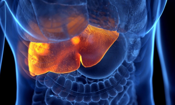 10 nguyên nhân không ngờ gây suy gan cấp: Số 3 nhiều người dễ mắc