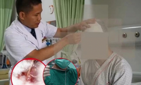 24 tuổi nhưng đã bị ký sinh trùng 10cm ăn não suốt 13 năm, bác sĩ kêu gọi dừng 3 thói xấu