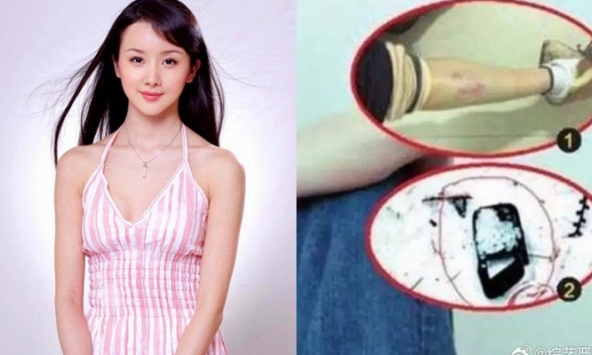 Scandal rúng động showbiz Trung: 'Đệ nhất mỹ nhân' bị bạo hành ngay trên phim trường, nhân chứng bị uy hiếp buộc phải im lặng