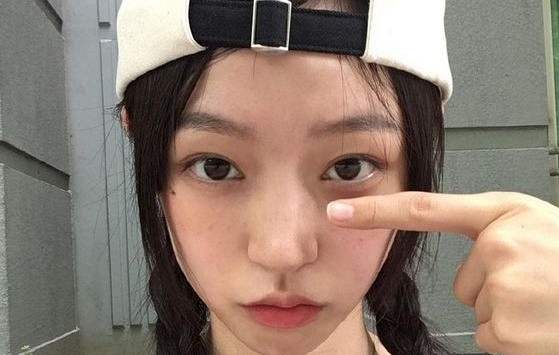 4 dấu hiệu ở ngón tay cho thấy chất độc tích tụ, cần sớm tầm soát ung thư gan và phổi