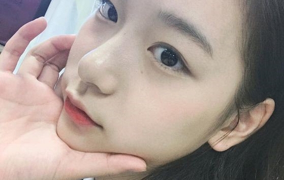 Bác sĩ chia sẻ 5 dấu hiệu cảnh báo bệnh gan có thể thấy ngay trên khuôn mặt