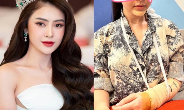 Hoa hậu Lý Kim Thảo bị tai nạn giao thông, phải rời khỏi Miss Universe Vietnam 2023