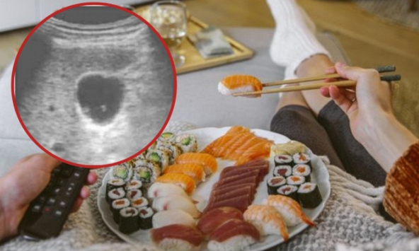 2 thói quen dễ khiến ký sinh trùng 'đục rỗng' gan, nhiều người mắc