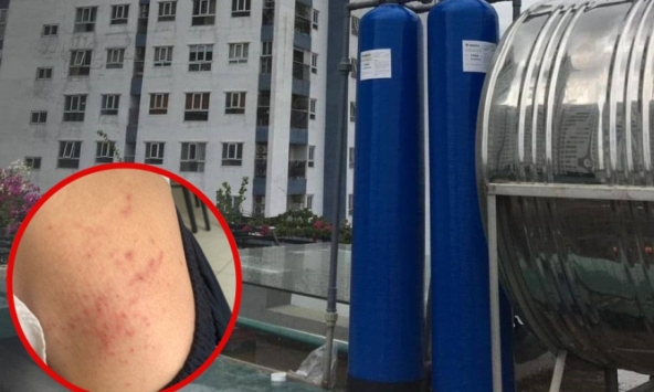 Hàng trăm hộ dân chung cư ở Hà Nội yêu cầu làm rõ nguồn nước sạch gây mẩn ngứa