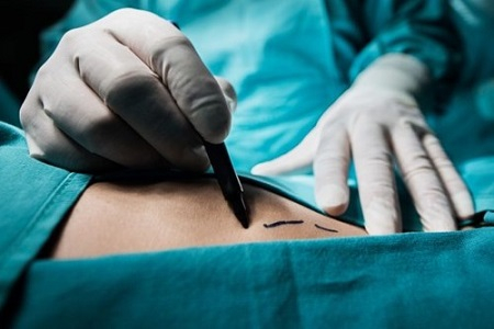 Bộ Y tế chỉ đạo khẩn sau thông tin phản ánh đường dây mua bán thận