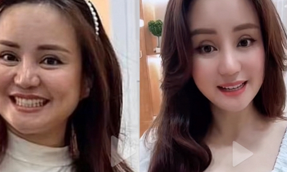 Xôn xao nhan sắc Vy Oanh qua camera thường, so với ảnh tự chụp khác biệt hẳn?