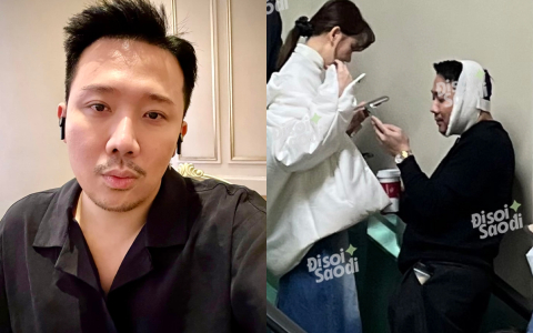 Trấn Thành đăng ảnh cận mặt, tiết lộ 1 điểm thay đổi giữa nghi vấn sang Hàn phẫu thuật thẩm mỹ? 