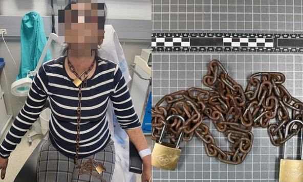 Người phụ nữ hốt hoảng đến bệnh viện cầu cứu với sợi xích trên cổ, biết nguyên nhân cảnh sát lập tức vào cuộc điều tra